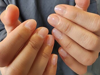アミックスネイル(Amix nail)/ちゅるワンカラー