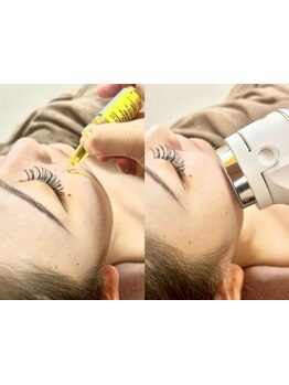 お肌をきれいにしたい