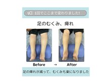 ケアフルはりきゅう施術院/Before→After
