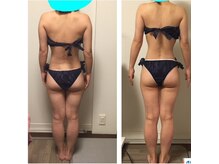 セルビューティー(Cell Beauty)の雰囲気（全身筋膜リリース☆サイズダウン、リフトアップ、セル脂肪◎）