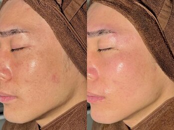 ルーナジェーナ(Luna llena)/