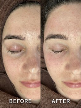 ベルミーランド マルエツ安行慈林/エステダーマBefore→After