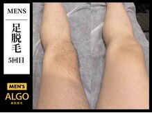 アルゴ 小倉守恒店(ALGO)/足脱毛
