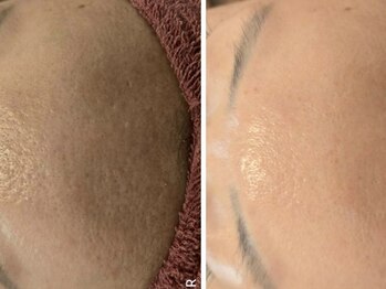 クレビア(CREBIA)/【シミ・シミケア専門店】沖縄県