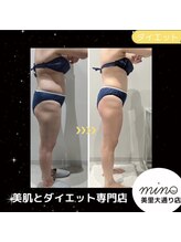 ミノ 美里大通り店(mino)/ダイエットパッケージ