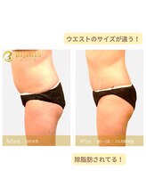 キングスサロン 熊本/ウエストほっそり！