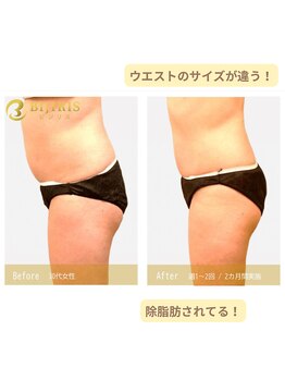 キングスサロン 熊本/ウエストほっそり！