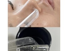 結果重視で必ずお肌を変えます！