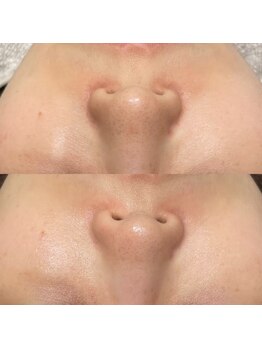 ビュウナ 銀座(BEAUNA)/ポテンザ