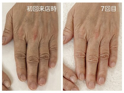 ハンドケアサロン キレイテ上野店 ＜手のシワ/乾燥/くすみ/血管の浮き/老け手＞の写真