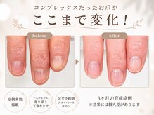 ナユネイル(na_yu.nail)