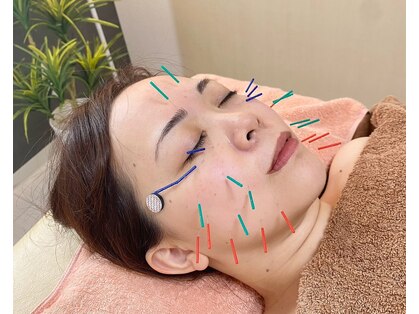 リリーフ(relief)の写真