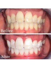 ホワイト 富山店(WHITE)/-３か月通い放題【無加工】-