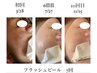【繰り返す大人ニキビ/肌質根本ケア】毛穴のゴワつきをキレイに♪11000→9900