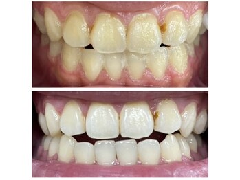 エクシア ホワイトニング 伊勢崎店/