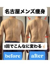 痩身ハイパーナイフメンズ【salon blue rose】新栄町/千種/痩身/ダイエット/脂肪燃焼/名古屋痩身/ハイパーナイフ/痩身