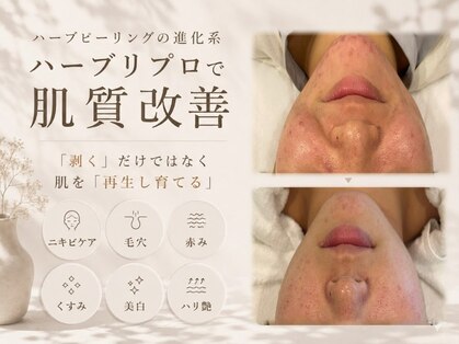 ルブラン セルラム コウベ(LeBLANC CELLULAM KOBE)の写真
