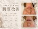 ルブラン セルラム コウベ(LeBLANC CELLULAM KOBE)の写真