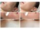 ナンバーフォーティーン(No.14)の写真