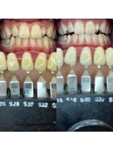 トウキョウスワーズ 池袋店(TOKYO SWRS)/#ホワイトニング #池袋 #渋谷