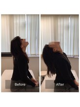 ナオル整体 新宿院(NAORU整体)/30代女性-姿勢矯正1ヶ月経過