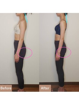 バストラボ 仙台店/【横向き2】首&ヒップ★