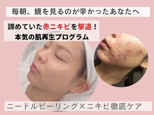 アロマ(AROMA)