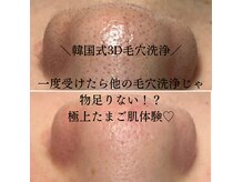 ダイヤモンド リーエンダ(Diamond leende)の雰囲気（【韓国式3D毛穴洗浄】毛穴トラブル改善◎1度で極上たまご肌♪）