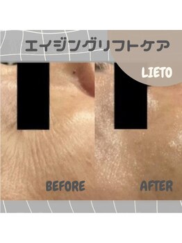 リエート(LIETO)/【エイジングリフトケア】