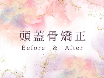 ココロ(COCORO)/頭蓋骨矯正