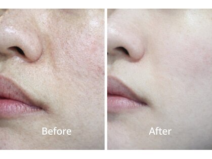 リジュルリジュル(Rigurerigure)の写真