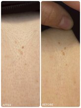 クレビア(CREBIA)/【シミ・シミケア専門店】沖縄県