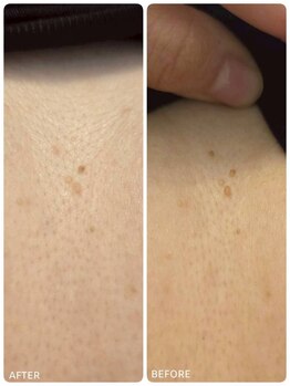 クレビア(CREBIA)/【シミ・シミケア専門店】沖縄県