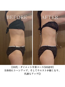 ヨサパーク スリー 西日暮里(YOSA PARK three)の写真/本気痩せは痩身専門店で!痩せる進化系よもぎ蒸し×リンパマッサージのWアプローチ◎【初回限定クーポン有】