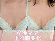 ヒヨコ 池袋西口店(Hiyoko)/バストアップ/育乳(１回施術)