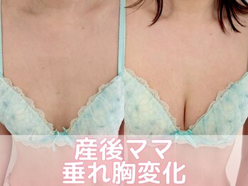 ヒヨコ 池袋西口店(Hiyoko)/バストアップ/育乳(1回施術)