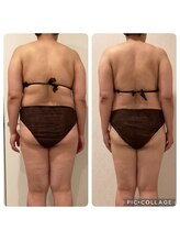 ボーテ(beaute)/【ビフォーアフター】