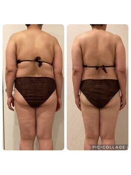 ボーテ(beaute)/【ビフォーアフター】