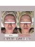 たるみ/むくみ/冷えが気になる方に**Bouquet式コルギ×漢方温熱デトックス
