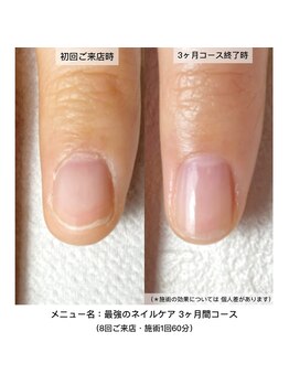 ネイルサロン ラピエトラ(la pietra)/最強のネイルケア3ケ月間コース