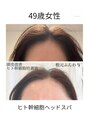 ミレマユメイク(mire)&nbsp;根元がふわっと立ち上がる大人のヘッドスパ/ヒト幹細胞培養液/眉