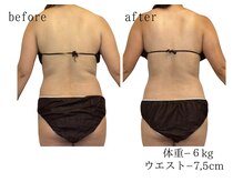 ココロミ(cocoromi)/ハイパーナイフ