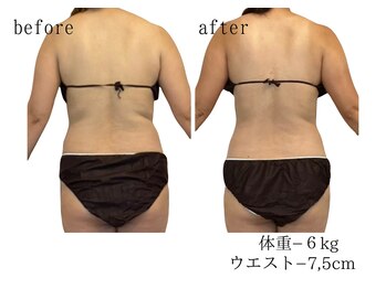 ココロミ(cocoromi)/ハイパーナイフ