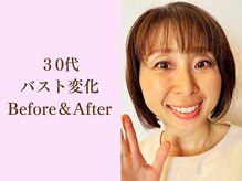 バストサロン メルベイユ(Merveile)/