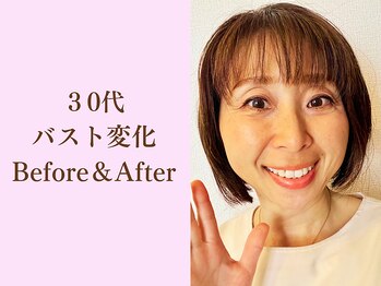 バストサロン メルベイユ(Merveile)/