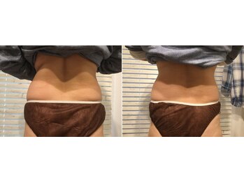 タマエステティックサロン 河辺店/痩身エステ