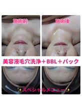 ルアナ(Luana)/オススメのスペシャルメニュー♪