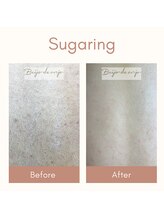 ベイジョ デ アンジョ(Beijo de anjo)/背中シュガーリング