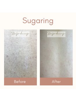 ベイジョ デ アンジョ(Beijo de anjo)/背中シュガーリング