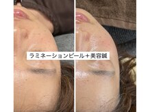 陽月 鍼灸院整骨院/トーンアップもリフトアップも◎